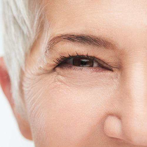 Anti-Wrinkle Injections